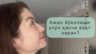 АЖИН ЙЎҚОЛИШИГА ҚАНЧА ВАҚТ КЕРАК?