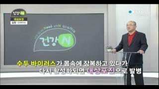 통증의 왕, 대상포진 / YTN 사이언스