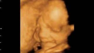 Jamee smiling inside the womb