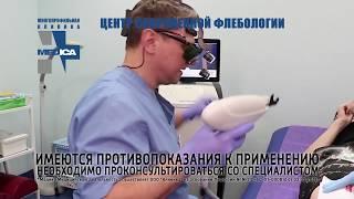 Диагностика и лечение варикоза в Пскове. Центр флебологии клиники MEDICA