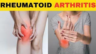 Comprehensive Guide to Rheumatoid Arthritis: From Symptom to Effective Treatment Healthy Habits Hub