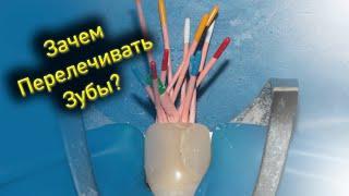 Зачем перелечивать зубы?