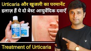 Best medicine for Urticaria | खाज खुजली की सबसे अच्छी आयुर्वेदिक दवा | Livcon & Assicon Syrup