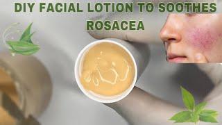 INGREDIENTS TO LOOK OUT FOR IF YOU HAVE ROSACEA/ DIY FACE LOTION FOR ROSACEA & SENSITIVE SKIN TYPES