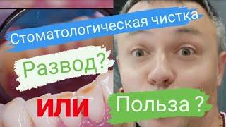 Вся правда о профессиональной гигиене. Биоплёнка. Стоматологический блог.