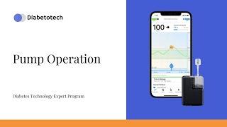 Pump Operation | Tandem Mobi Insulin Pump | Diabetotech