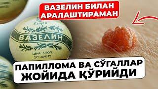 СЎГАЛ ВА ПАПИЛЛОМА БУ МАЛҲАМДАН ҚЎРҚАДИ! СУРТИНГ ВА ХАЛОС БЎЛИНГ. ТЕРИНИ ПАРВАРИШ ҚИЛИШ