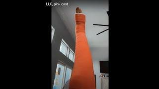 Broken leg, full leg cast, crutches, LLC, pink cast