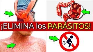 REVEALED! PARASITES in the INTESTINE ALARM SYMPTOMS | GET RID of PARASITES QUICKLY