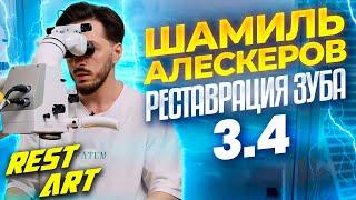 Реставрация зуба 3.4 - Шамиль Алескеров | RestART