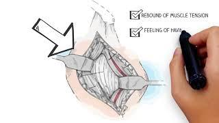 Multimodal Pain Management