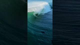 Can you Imagine breaking your femur whilst surfing your local wave!?