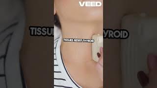 Understanding Free T4  Thyroid Health Insights