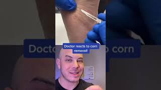 Doctor reacts to corn removal on the foot! #corn #itscorn #dermreacts