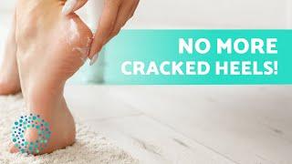 How to REMOVE FOOT DRYNESS  (Cause, Treatments and Home Remedies)