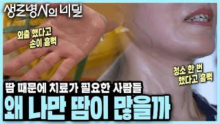 더워지니 더 미치겠다! 땀으로 고통 받는 질병, 다한증과 액취증의 원인과 치료법 I KBS 20230906 방송