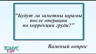 Будут ли заметны шрамы после операции по коррекции груди?