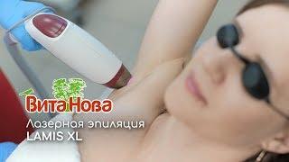 Лазерная эпиляция LAMIS XL