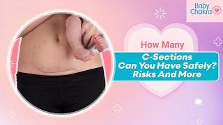 How Many C-Sections Can You Have Safely? Risks And More | C-Section Pregnancy | BabyChakra