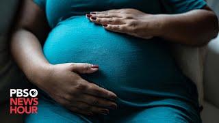 American Black women face disproportionately high rates of maternal mortality