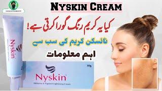 How To Remove Hyperpigmentation , Melasma , Dark Albow , Nyskin Cream Honest Review | for Freckles