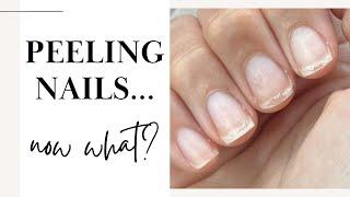 Peeling Nails? You’ll Wish You Found This Video Sooner ️
