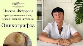 Онихогрифоз. Обучение подологов. Врач дерматолог Инесса Федорова. Центр PROcvet #подология