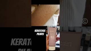 Skin Problems? Best products in Sephora.  Love Dr V Xx