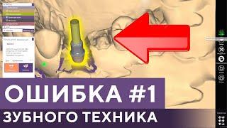 ГЛАВНАЯ ОШИБКА зубного техника при сканировании работы. EXOCAD