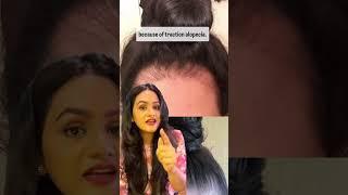 3 Things I Never Do to My Hair | Doctor Rekha | #ayurvedahairgrowth #healthyhairtips #haircare