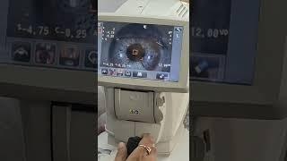 IRIS eye through magnifying machine #eyes #science #big #magnified #doctor #iris #technology