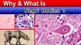 What is Negri bodies ?  ( Clear Explain )