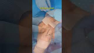 Key Steps: Insertion of a Right-Sided PleurX Catheter for Palliation of a Malignant Pleural Effusion