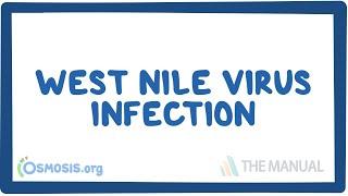 West Nile virus infection - causes, symptoms, diagnosis, treatment, pathology