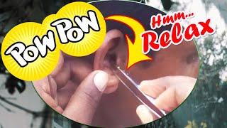 Removal Chunky-Chunky Dirtwax by Expert Guy / Most Satisfying Ear Cleaning with Relaxing Rain Sounds