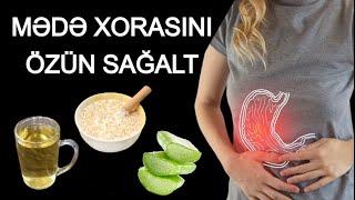 Mədə Xorasının Evdə ƏN TƏBİİ MÜALİCƏSİ - Sadəcə Bunları Etmək Lazımdır