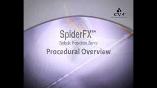 Spider FX