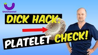 TWEAKING the P-SHOT for better ERECTIONS!| UroChannel