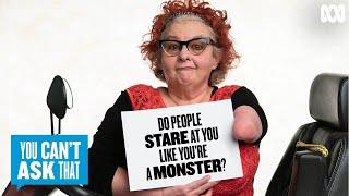 Amputees answer "Do people stare at you like you're a monster?" | You Can't Ask That