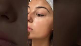 Finishing Touch Flawless Face Device