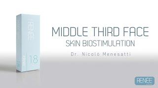 Treatment | Middle Third Face | RENÉE Prime