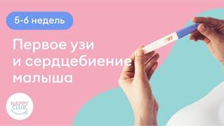 5-6 недель. Первое узи и сердцебиение малыша