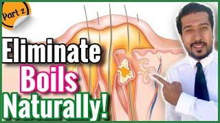 5 Natural Ways to Get Rid of Boils | Treat a Boil at Home FAST