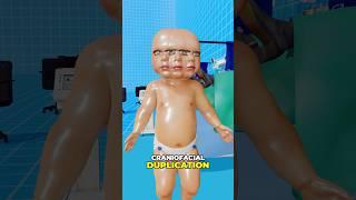 People Born With EXTRA Body Parts?!  #shorts