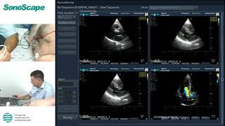 Мастер-класс на аппарате SonoScape S8Exp. Лектор: Алехин М.Н.