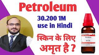 PETROLEUM 30.200.1M Use in hindi / Petroleum 30 use, / Petrolium Pomeopathic Medicine