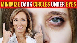 Dark Circles Under Eyes | How to get Rid of Dark Circles | Dr. Janine