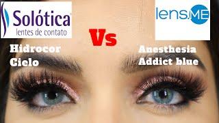 Solotica vs Anesthesia LENSES! *NEW comparison video