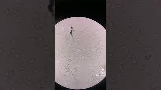 Let's view white mucus in urine under the microscope #microscope #mucus #urinalysis #infection #mls