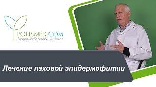 Лечение паховой эпидермофитии: противогрибковые средства, антимикотики. Народная медицина